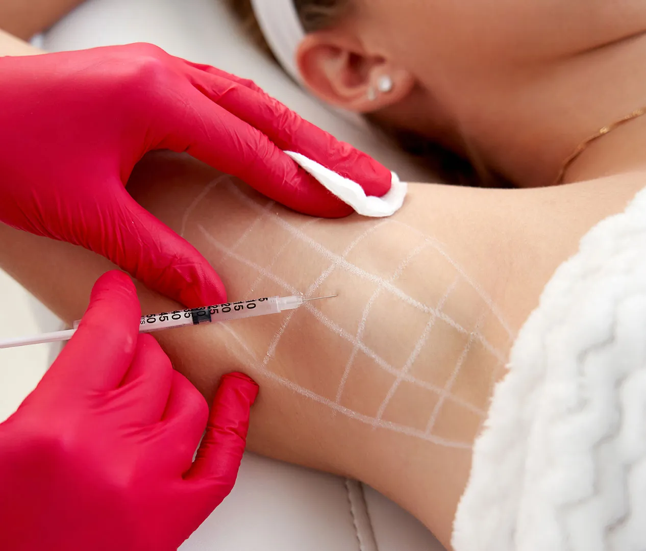 Anti-wrinkle Injection for Sweating: What Is It, How It Works, Target Areas and Benefits